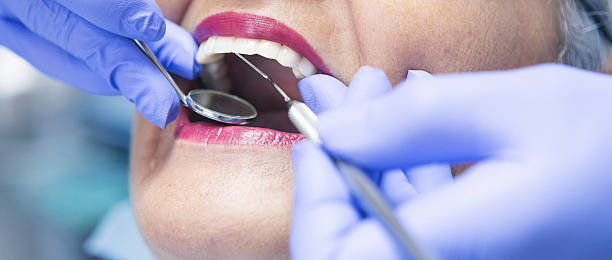 Best Teeth Whitening  in Henry, IL